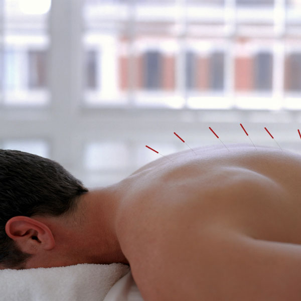 Acupuncture for Athletes